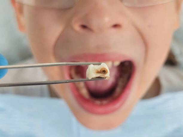 Best After-Hours Dental Care in Ocilla, GA